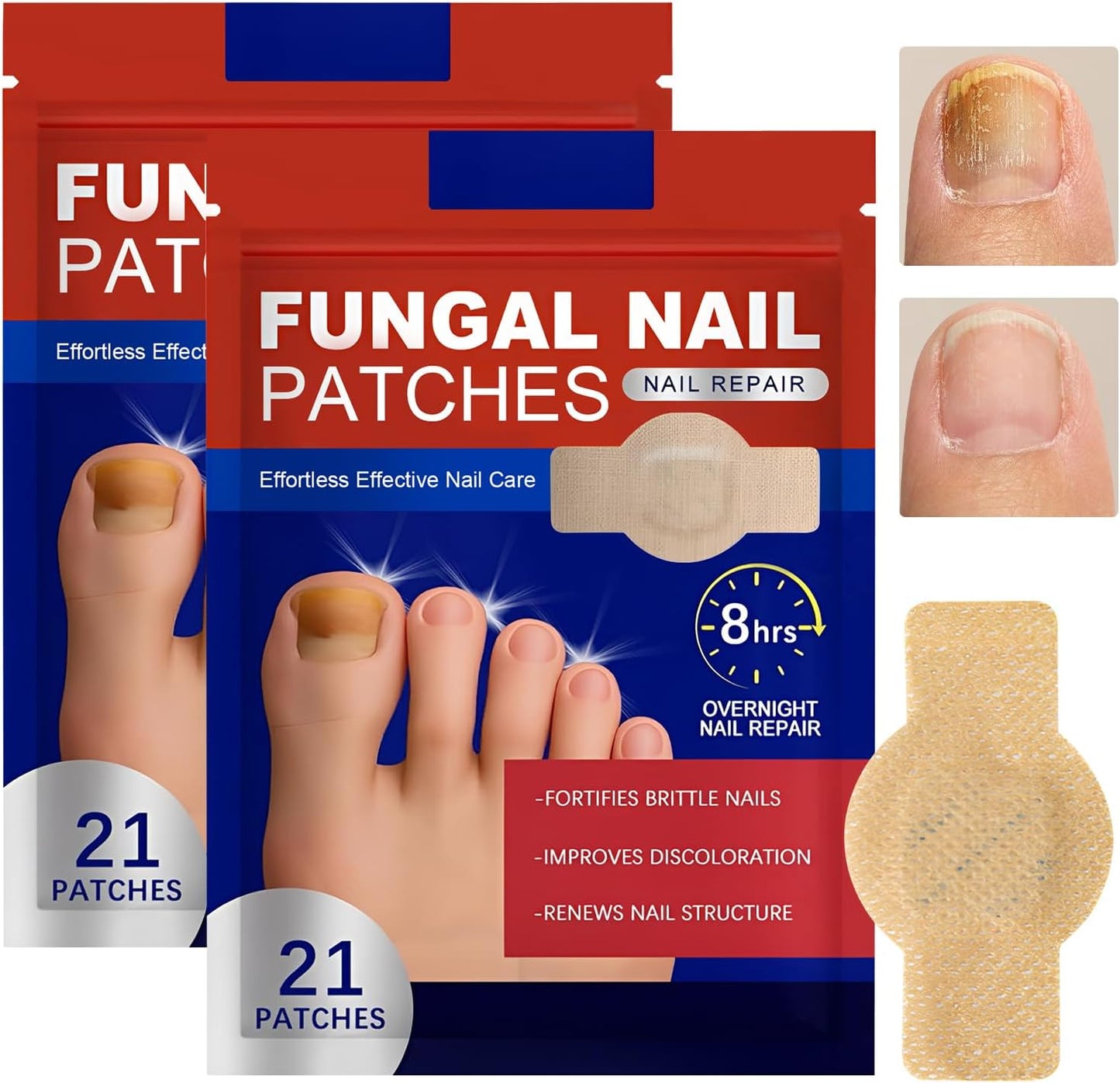 Fungal Nail Repair Patches