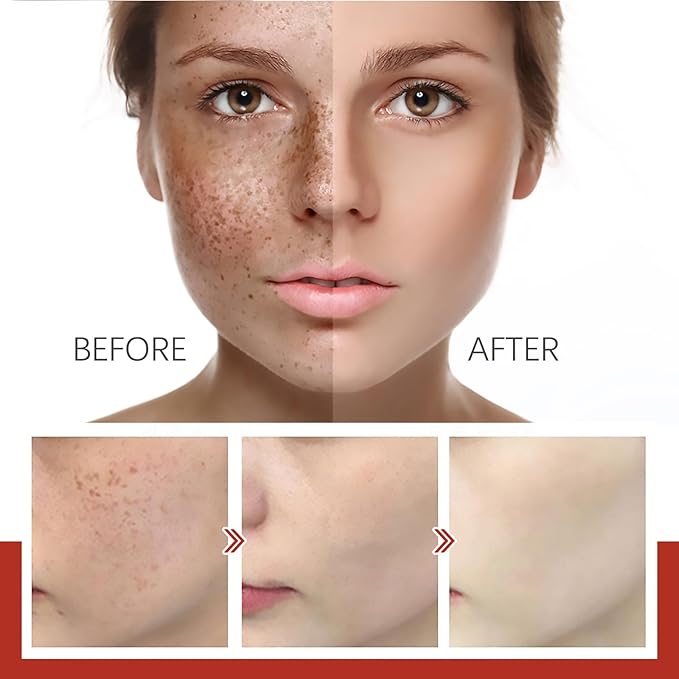 Eelhoe - Pigment Correcting Cream